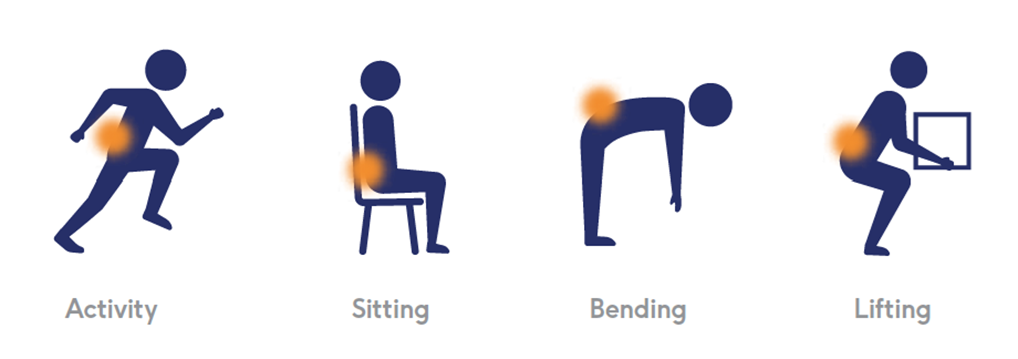 Intracept Procedure For Chronic Low Back Pain 